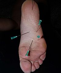 Amateur Needle Pain